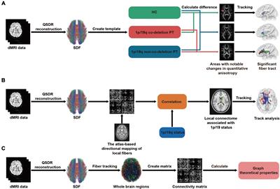 Connectomic insights into the impact of 1p/19q co-deletion in dominant hemisphere insular glioma patients